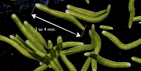   Xenocoelomorpha：単細胞の驚異！海の底で暮らす謎多き生物たち